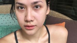 10 Foto BCL Tanpa Makeup, Tetap Cantik Walau Bibir Kering dan Mata Berkantung