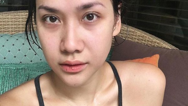 10 Foto BCL Tanpa Makeup, Tetap Cantik Walau Bibir Kering dan Mata Berkantung