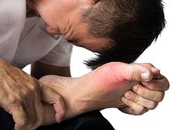 Tangan dan Kaki Keram Setiap Habis Makan Nasi, Mungkinkah gegara Diabetes Dok?