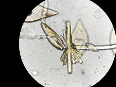 Foto: Kristal-kristal Cantik Asam Urat dalam Tangkapan Lensa Mikroskop