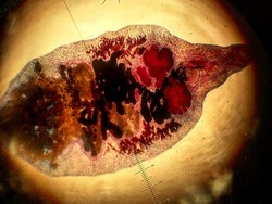 Para Veteran Perang Vietnam Terancam Parasit Penyebab Kanker Hati