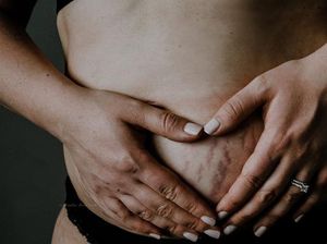 Foto: Garis dan Lipatan Cinta di Perut Ibu