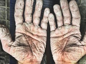 Tebak Tangan Ini Milik Siapa! yang Jelas Bukan Tangan Lansia Tebak Tangan Ini Milik Siapa! yang Jelas Bukan Tangan Lansia