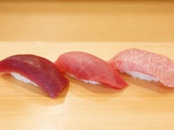 Hii... Ini Cacing Pita 1,7 Meter dari Perut Pencinta Sushi