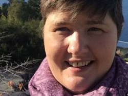 Gara-gara Sering Migrain, Wanita Ini Terancam Dipecat