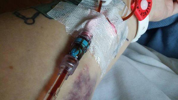 Foto-foto Ini Buktikan Anemia Tidak Boleh Disepelekan