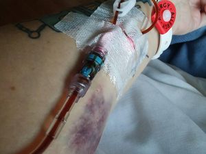 Foto-foto Ini Buktikan Anemia Tidak Boleh Disepelekan