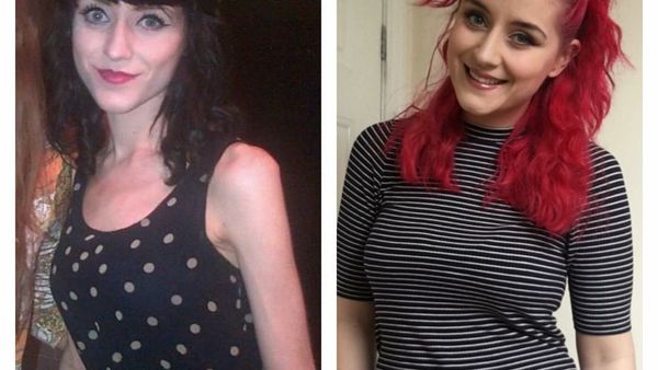 Potret Ekspresi Kontras Penyandang Depresi, Bisakah Kamu Membedakan?