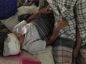 Tertembak dan Kena Bom, Anak-anak Rohingya Dirawat di Bangladesh