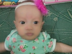 Bayi Debora Meninggal, Dinkes DKI akan Panggil RS Mitra Keluarga