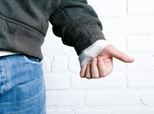 Ibu Jari Tangan Pria Ini Putus, Dokter Menukarnya dengan Jempol Kaki Ibu Jari Tangan Pria Ini Putus, Dokter Menukarnya dengan Jempol Kaki