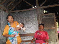 Nisa, Penderita Gizi Buruk di Blitar Hidup di Rumah Tak Layak