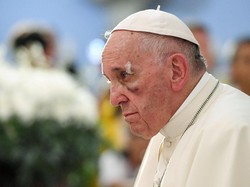 Terbentur Mobil Saat Temui Jemaat di Kolombia, Paus Fransiskus Lebam