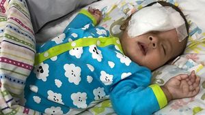 6 Gejala Katarak Anak Seperti yang Dialami Putra Asri Welas