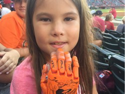 Keren! Meski Bertangan Robotik, Bocah Ini Jago Baseball