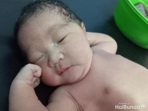 Yuk, Kenali Berbagai Masalah Kulit Bayi Baru Lahir