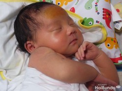 Timbul Bercak Merah di Wajah Bayi ASI, Sudah Pasti Ruam Susu?