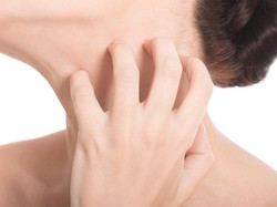 Ketika Kulit Habis Digigiti Tungau di Dalam Pesawat