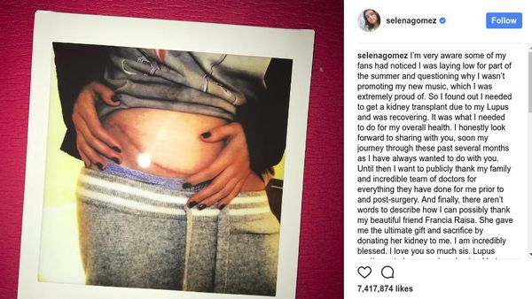 Mengenal Lupus Nephritis, Penyakit yang Menyerang Selena Gomez