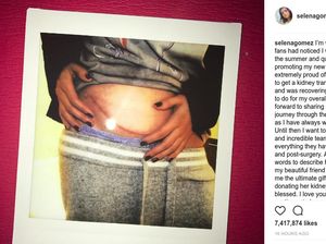 Mengenal Lupus Nephritis, Penyakit yang Menyerang Selena Gomez