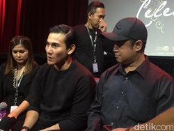 Vino G Bastian Kenakan Gusi Palsu demi Perankan Chrisye