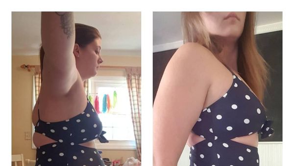 Foto: Kumpulan Pejuang Tiroid yang Berhasil Menurunkan Berat Badan