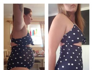 Foto: Kumpulan Pejuang Tiroid yang Berhasil Menurunkan Berat Badan