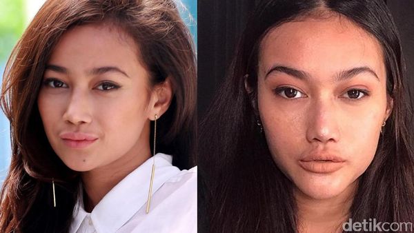 Dibilang Bentuk Bibirnya Berubah, Ini Transformasi Ratu Felisha