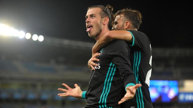 Gareth Bale mengalami cedera kedua di musim 2017/2018.