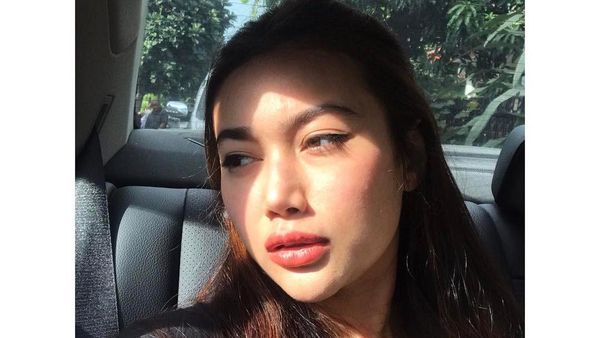Foto: Bibir Ratu Felisha yang Disebut Netizen Makin Tebal, karena Filler?