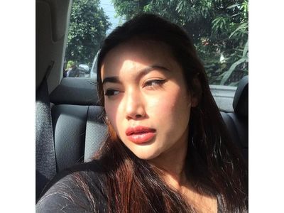 Foto: Bibir Ratu Felisha yang Disebut Netizen Makin Tebal, karena Filler?