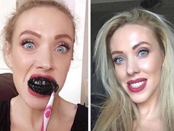 Tren Memutihkan Gigi dengan Arang Aktif, Baik atau Tidak?