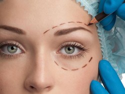 Tren Bedah Kelopak Mata Meningkat di Indonesia, Pasien Mulai dari Anak Kecil