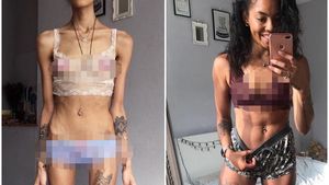 Foto Transformasi Luar Biasa Mantan Pengidap Gangguan Kecemasan