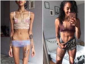 Foto Transformasi Luar Biasa Mantan Pengidap Gangguan Kecemasan