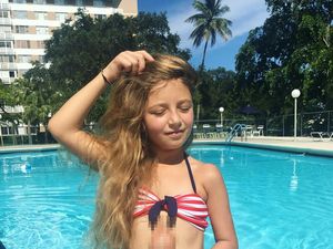 Potret Bocah Perempuan dengan Jantung di Luar Tubuh