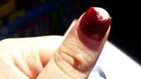 Bikin Ngilu! Potret Kuku yang Rusak karena Pakai Kuku Palsu Sembarangan