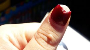 Bikin Ngilu! Potret Kuku yang Rusak karena Pakai Kuku Palsu Sembarangan