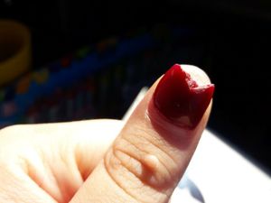 Bikin Ngilu! Potret Kuku yang Rusak karena Pakai Kuku Palsu Sembarangan Bikin Ngilu! Potret Kuku yang Rusak karena Pakai Kuku Palsu Sembarangan