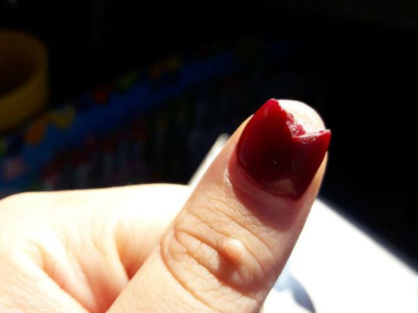 Bikin Ngilu! Potret Kuku yang Rusak karena Pakai Kuku Palsu Sembarangan