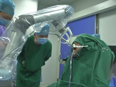 Foto: Prosedur Pemasangan Implan Gigi oleh Robot di Cina