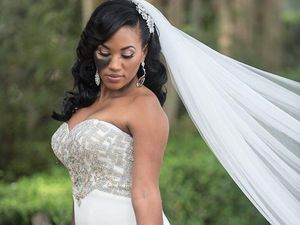 Alasan Inspiratif Wanita Ini Tak Tutupi Tanda Lahir di Wajahnya Saat Menikah