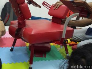 RSHS Siapkan Kursi Khusus Balita Kembar Siam Asal Garut