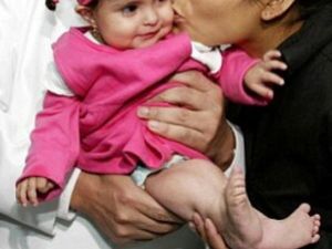 Potret Anak-Anak yang Terlahir sebagai Putri Duyung