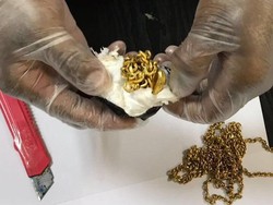 Selundupkan 1 Kg Emas di Duburnya, Pria Sri Lanka Ditangkap