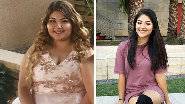 Potret Transformasi Ekstrem Para Wanita Cantik yang Sukses Kuruskan Badan