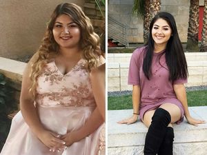 Potret Transformasi Ekstrem Para Wanita Cantik yang Sukses Kuruskan Badan