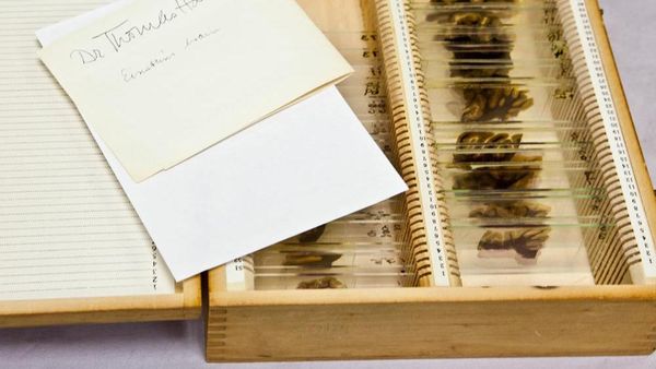 Inikah Otaknya Albert Einstein?