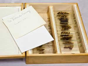 Inikah Otaknya Albert Einstein?