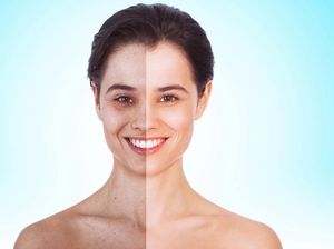 Getty Images Tolak Foto Hasil Editan